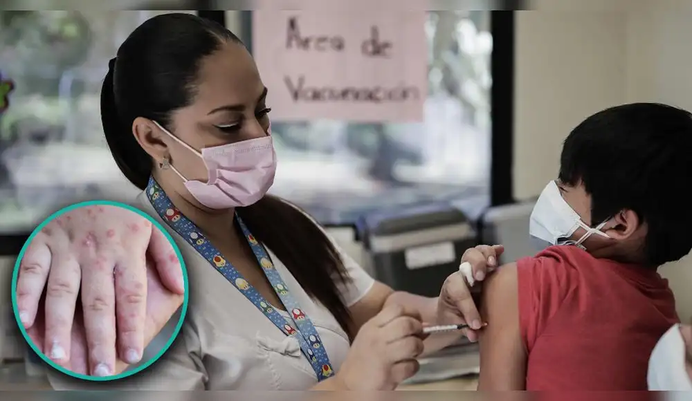 Gobierno se propone combatir polio y sarampión Gobierno se propone combatir polio y sarampión