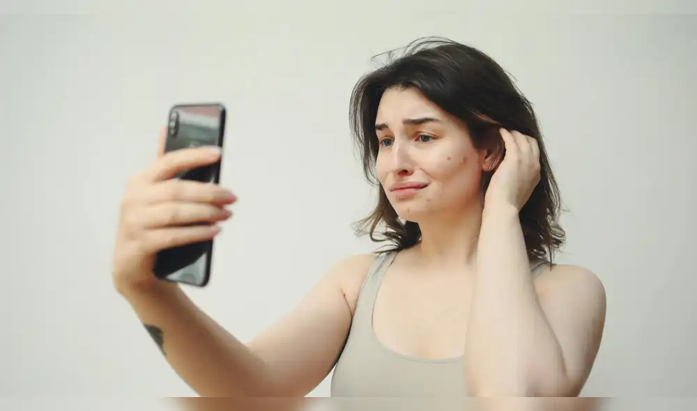 QNatur ayudaría a mejorar la autoestima de personas que sufren de acné. Fuente: Pexels.