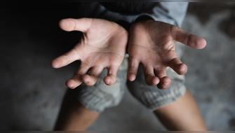 Crisis infantil en aumento: UNICEF destaca pobreza extrema en África, Asia y Perú