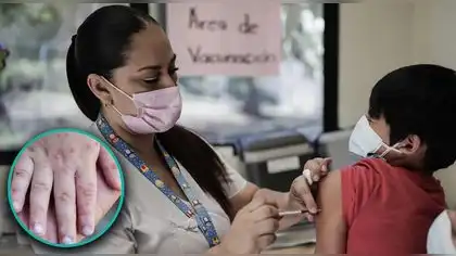 Gobierno se propone combatir polio y sarampión Gobierno se propone combatir polio y sarampión