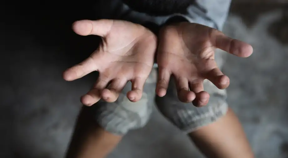 Crisis infantil en aumento: UNICEF destaca pobreza extrema en África, Asia y Perú